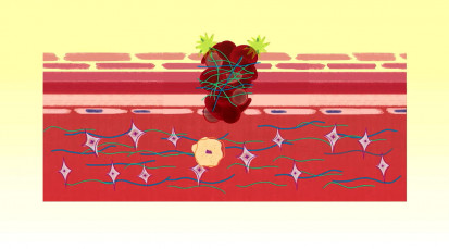 cvt-How a wound heals itself - Sarthak Sinha.mp4